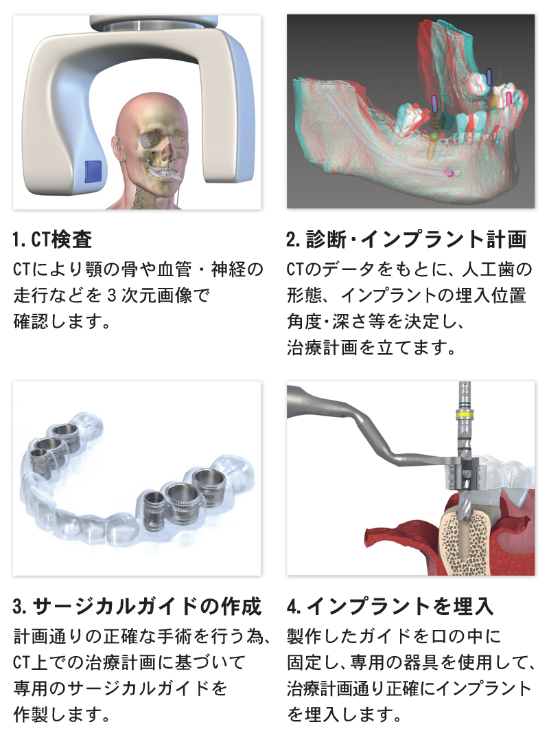 コンピュータガイデッドサージェリー