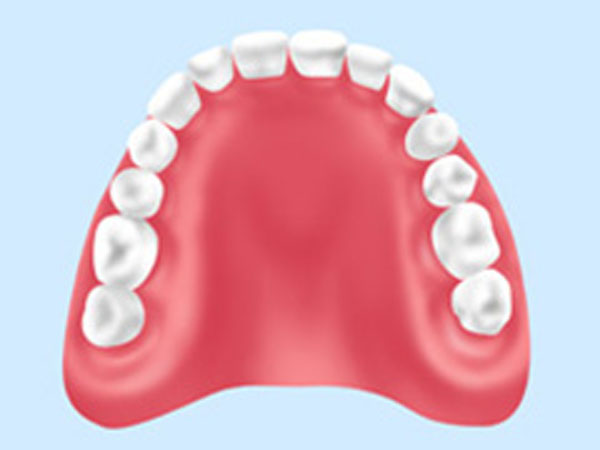 レジン床義歯（保険適用）