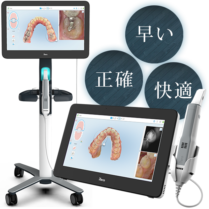 インビザライン専用口腔内スキャナーiTero（アイテロ）