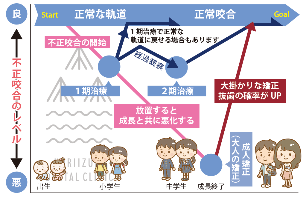 小児矯正歯科の治療の流れ