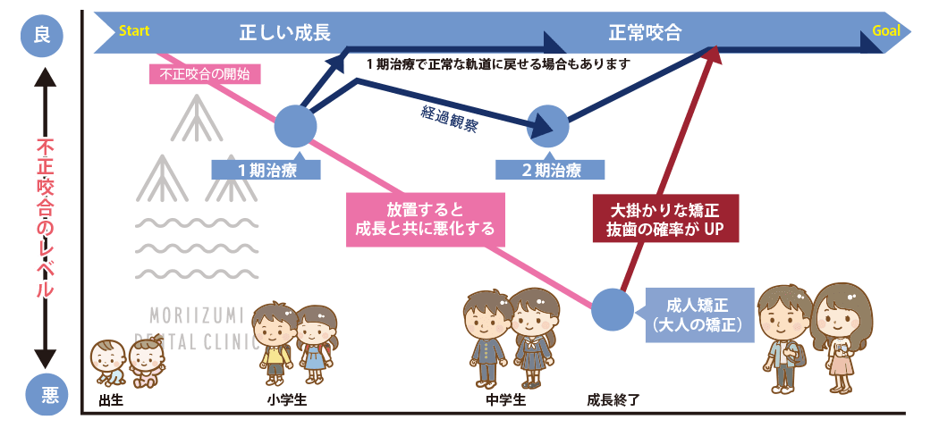 小児矯正歯科の治療の流れ