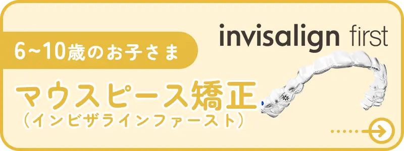 マウスピース矯正
