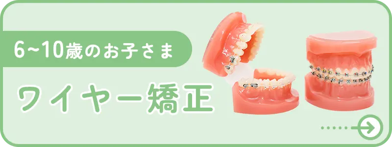 ワイヤー矯正